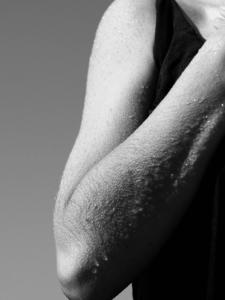 pexels-photo-17776767-17776767 Detailed monochrome close-up of a human arm showing goosebumps and wet skin.